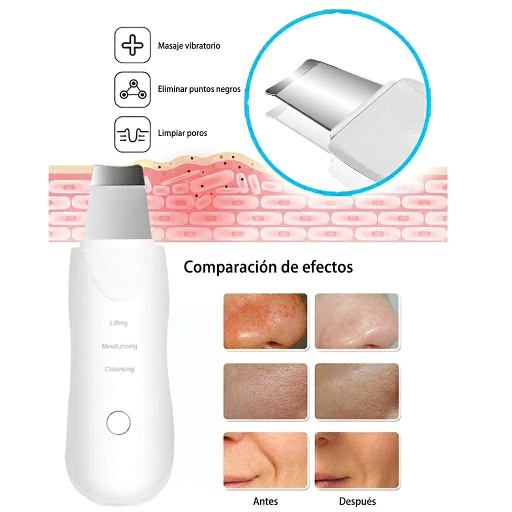 Peeling Ultrasónico – Limpiador de Poros Skin Scrubber